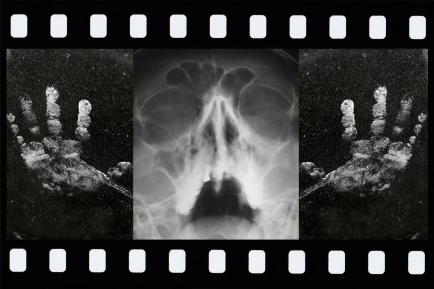 X-RAY-FILM-404-AA2